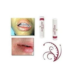 forever aloe lips tratamiento labios agrietados balsamo organico 3